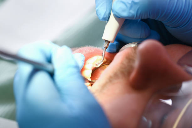 Best Emergency Broken Tooth Repair in Upper Montclair, NJ