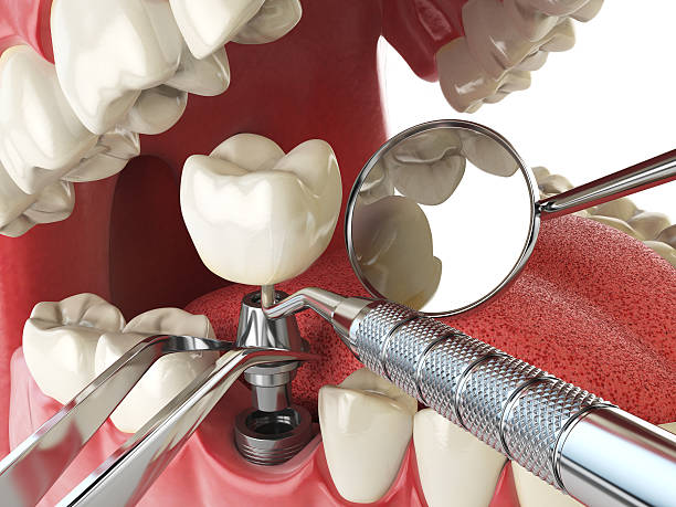 Best Emergency Dental Care for Trauma or Injury in Upper Montclair, NJ